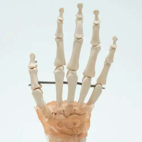 COL 1114-A - Articulação da Mão com Ligamentos - Image 4